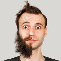 Beard Transplant 04 2 Beard Transplant 04 2