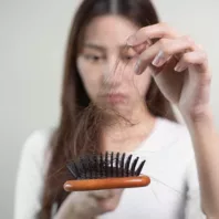 Hairloss-01 Hairloss-01