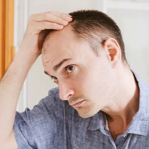 Saç İncelmesinin Nedenleri-04